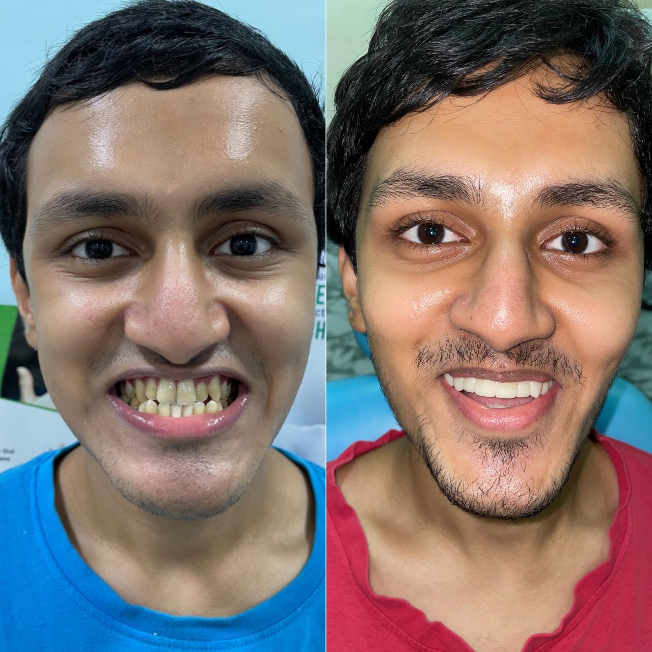 before-after8